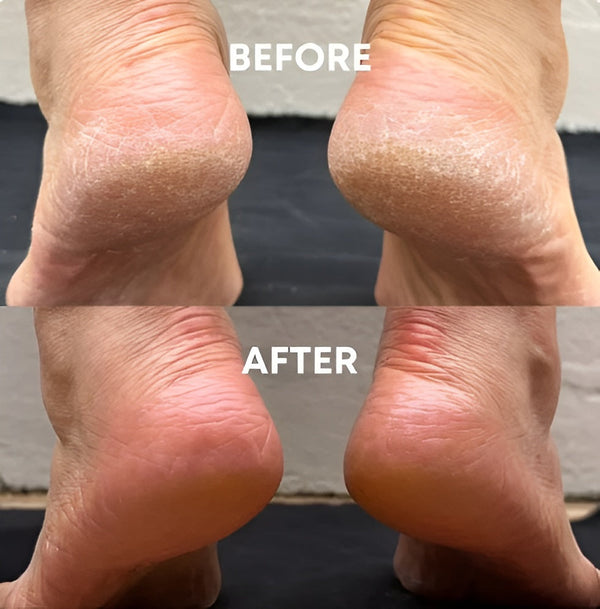 Fresh Feet In Seconds